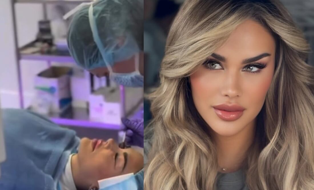 Como Ninel Conde, ¿quieres cambiar tu color de ojos? Esto cuesta la queratopigmentación (Foto: Instagram)