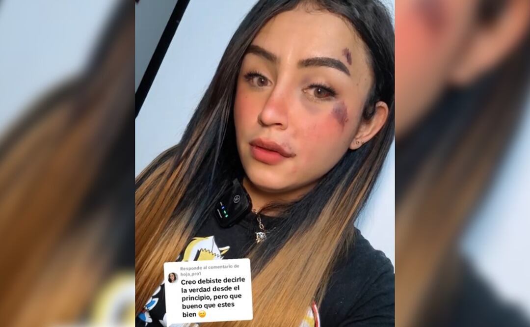 Influencer trans golpeada brutalmente, reacciona a quienes la culpan por la ira de su agresor 