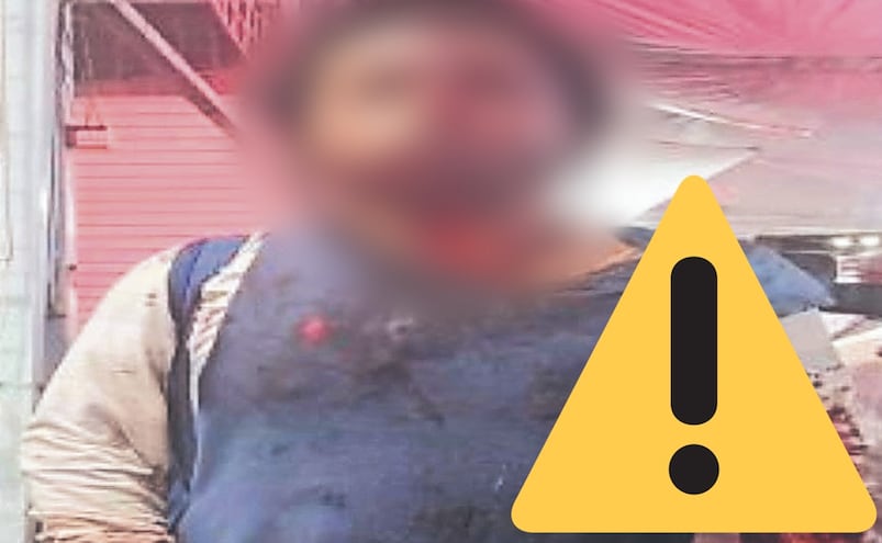 Navajean a pepenador y él mismo busca patrulla para denunciar al agresor, en la Cuauhtémoc