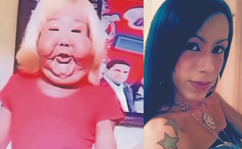 La trágica historia de la influencer que con un tratamiento "patito" destruyó su rostro. Foto: (Especial)