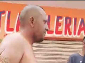 Explosión de Pipa en Puente La Concordia: Video de declaraciones de heridos