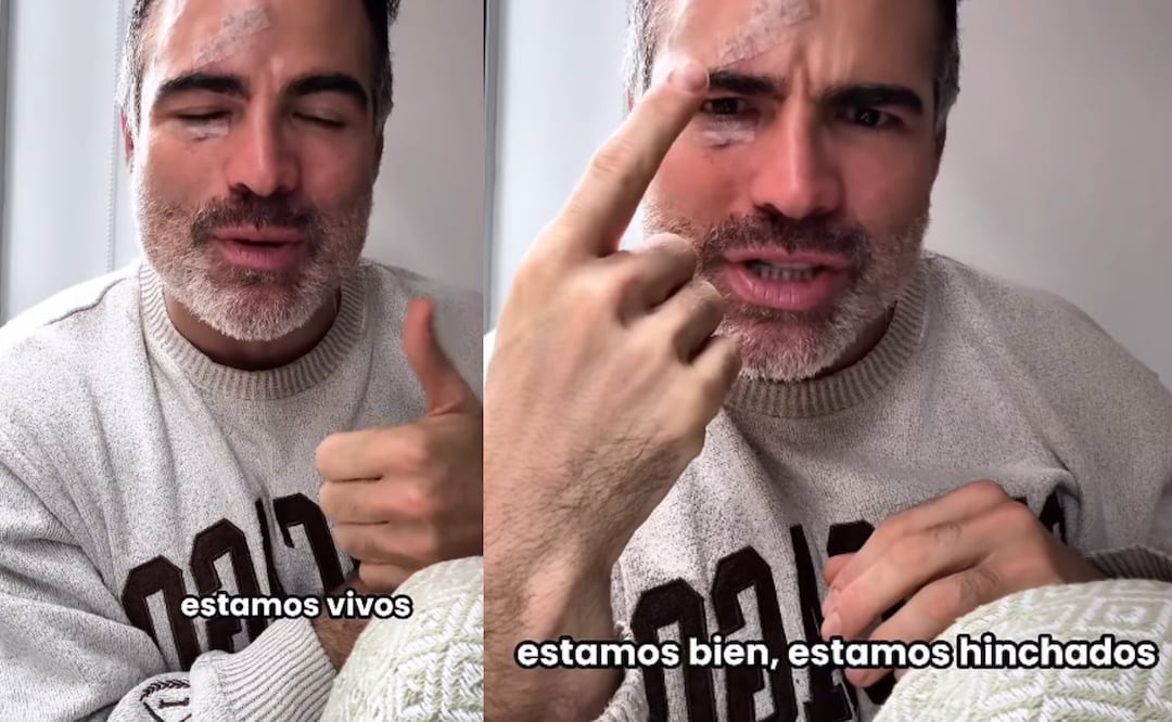 Actor sufre fuerte accidente en pleno escenario y termina en cirugía de emergencia (Foto: Instagram)