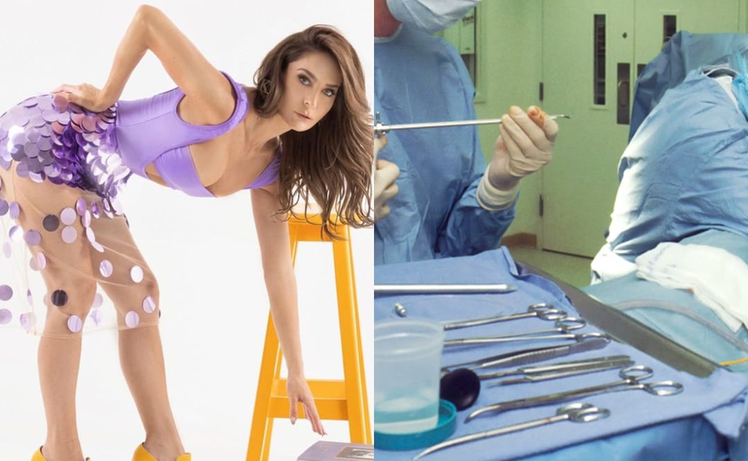 ¡Se fue sin pagar! Geraldine Bazan rejuvenece sus labios... y no los de la cara