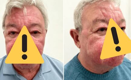 Su gran nariz le impedía chupar chela y besar a su mujer, así fue el martirio