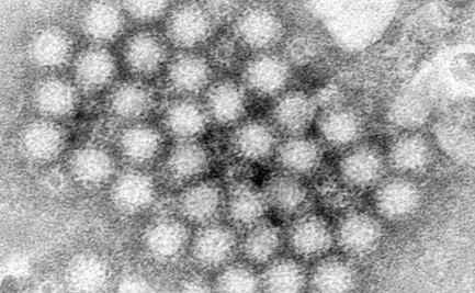 Suenan las alertas por aumento de casos del “virus del vómito invernal”