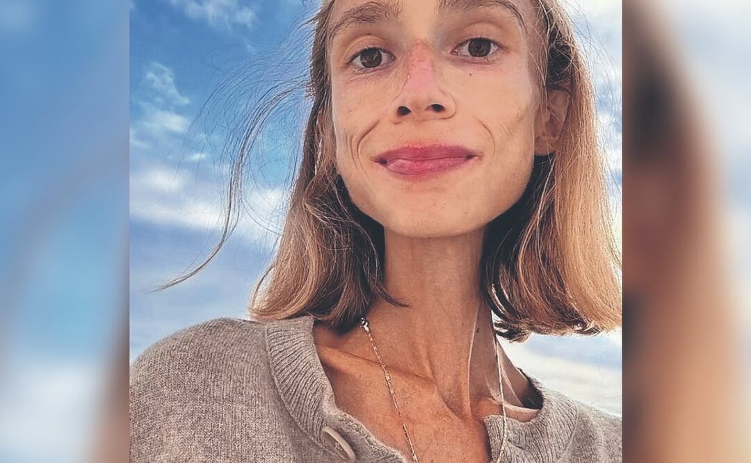 Joven muere por dieta extrema (Foto: Instagram)