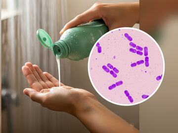 Profeco alerta por champú contaminado con bacteria Klebsiella Oxytoca ¿cuál es y qué hacer?