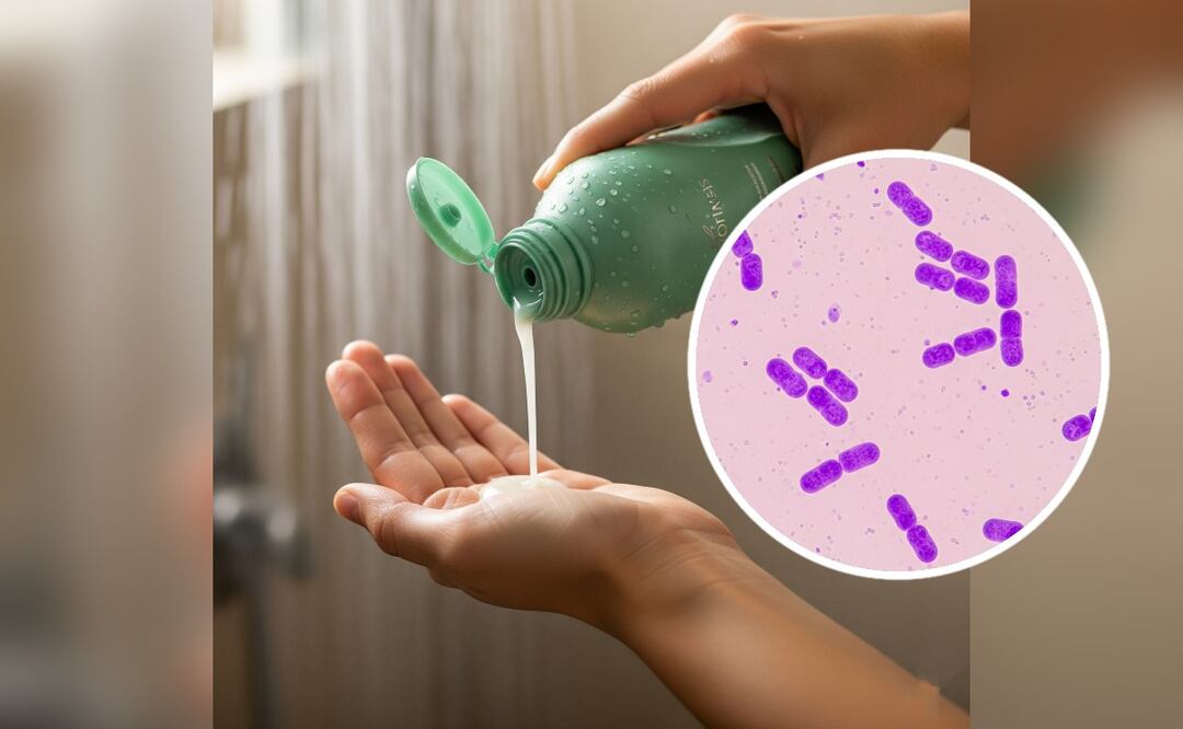 Imagen ilustrativa: IA (Profeco alerta por champú contaminado con bacteria Klebsiella Oxytoca ¿cuál es y qué hacer?)