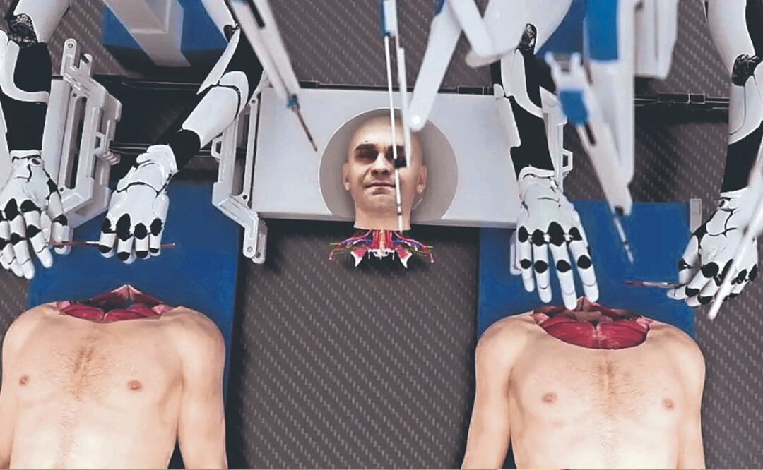 Trasplantes de cabeza podrían ayudar a personas con Alzheimer, Parkinson o Cáncer