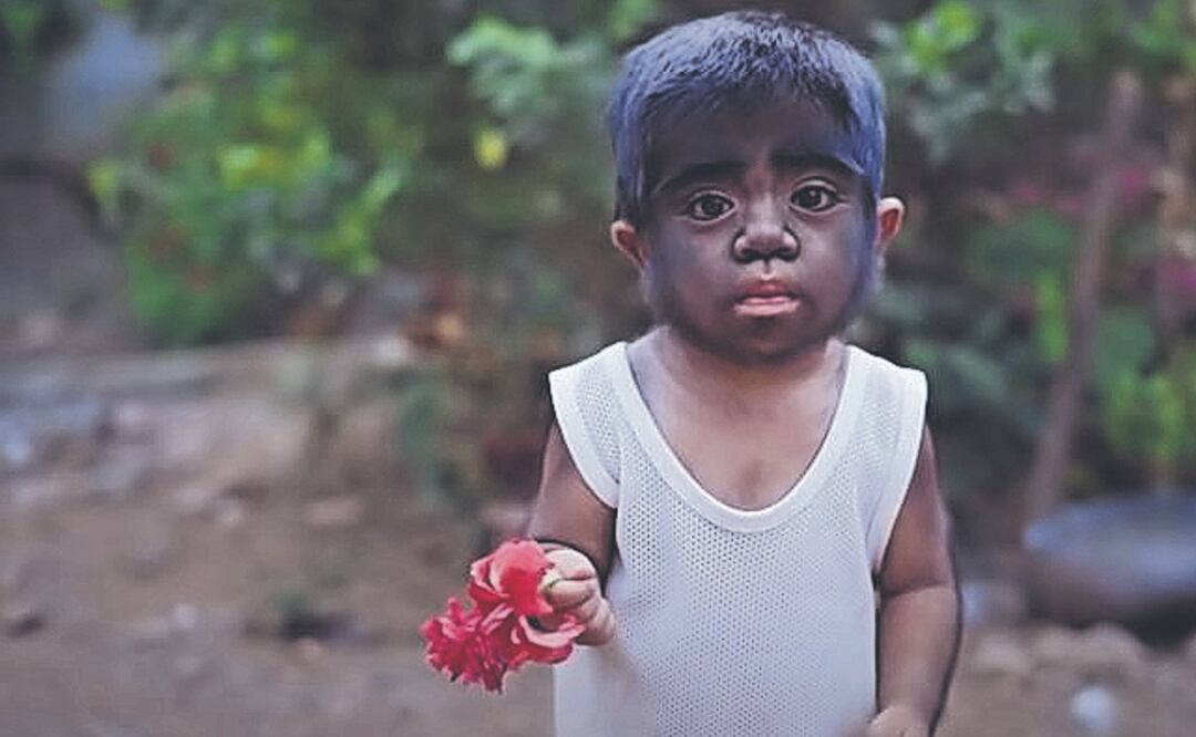 Nació “bebé lobo”, madre cree que es una maldición por algo que hizo durante el embarazo