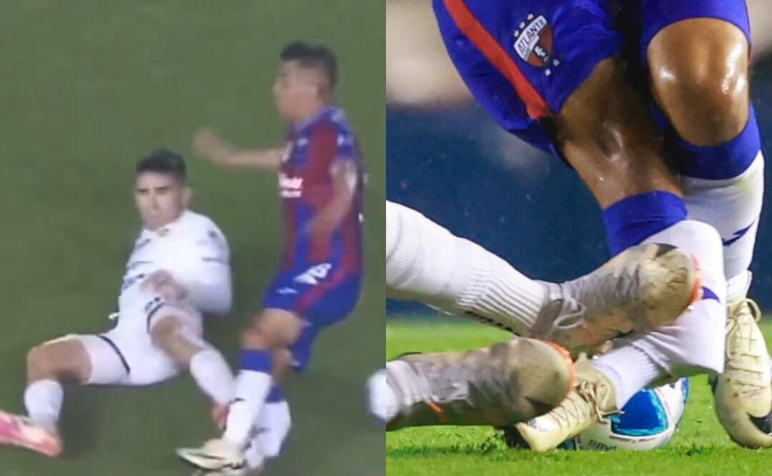 Christian “Hobbit” Bermúdez: VIDEO| Así fue la escalofriante lesión del jugador del Atlante