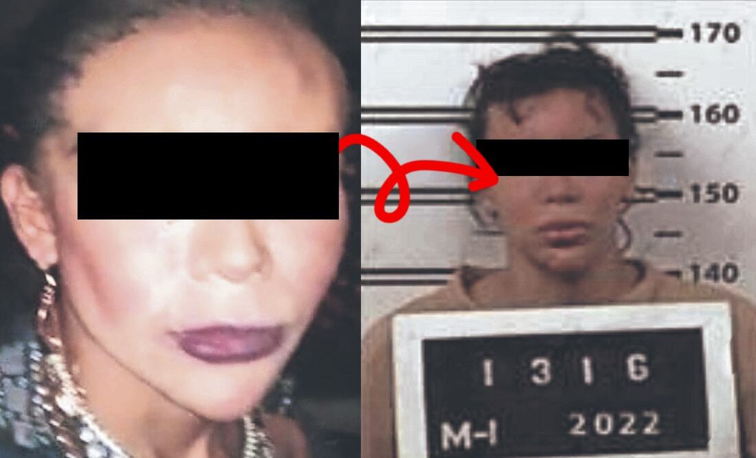 Mujer trans herida en Tlalpan (Foto: X)I