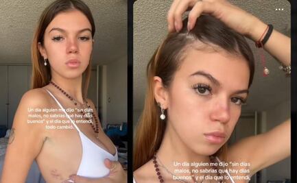 Valentina Gilabert muestra sus cicatrices y lanza mensaje de fuerza tras el ataque de Marianne