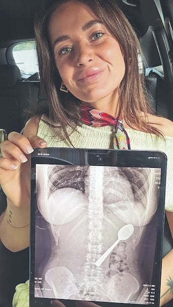 Una mujer se la tragó completa y su novio quiere hacerla obra de arte ¿De qué se trata?. Foto: (Metro UK)