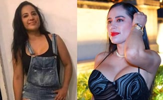 Sandra Cueva de menos mil de aura a farmearla a través de sus cirugías