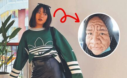 Mujer embarazada sufre transformación facial severa, ¿conocías este riesgo?