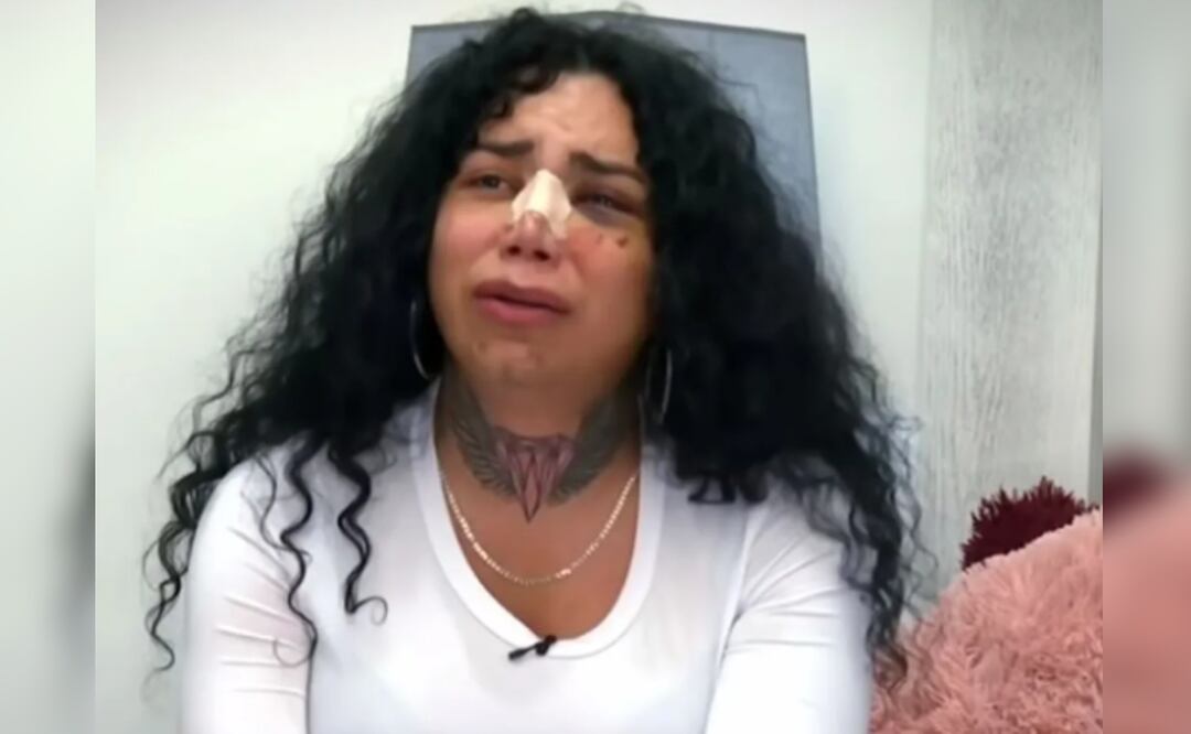 Paola Suárez revela la fuerte suma que le robó su ex el día que la golpeó