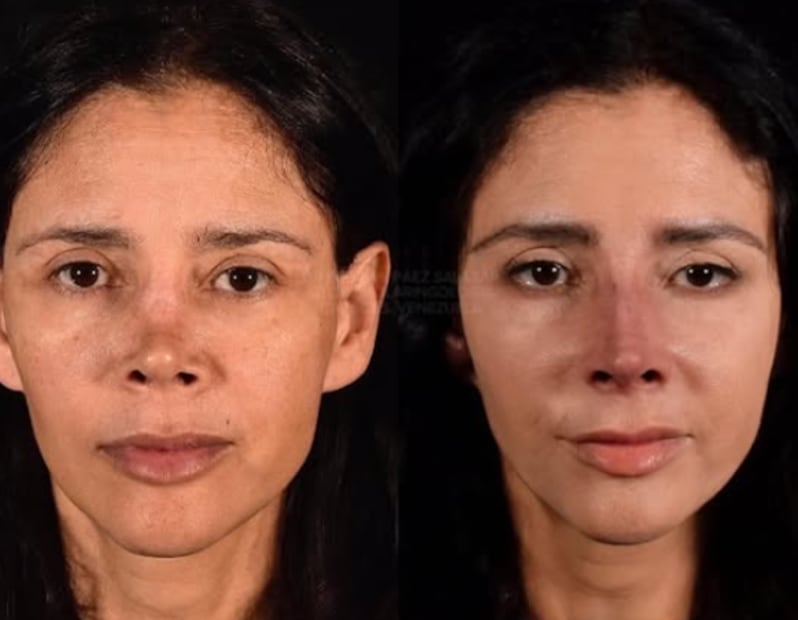 Dorismar, antes y después (Foto: Instagram)