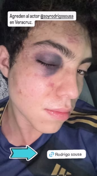 Actor golpeado (Foto: Instagram)