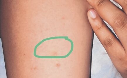 Chava acusa pinchazo en el Metro CDMX y omisión de protocolo, ¿hubo negligencia de las autoridades?