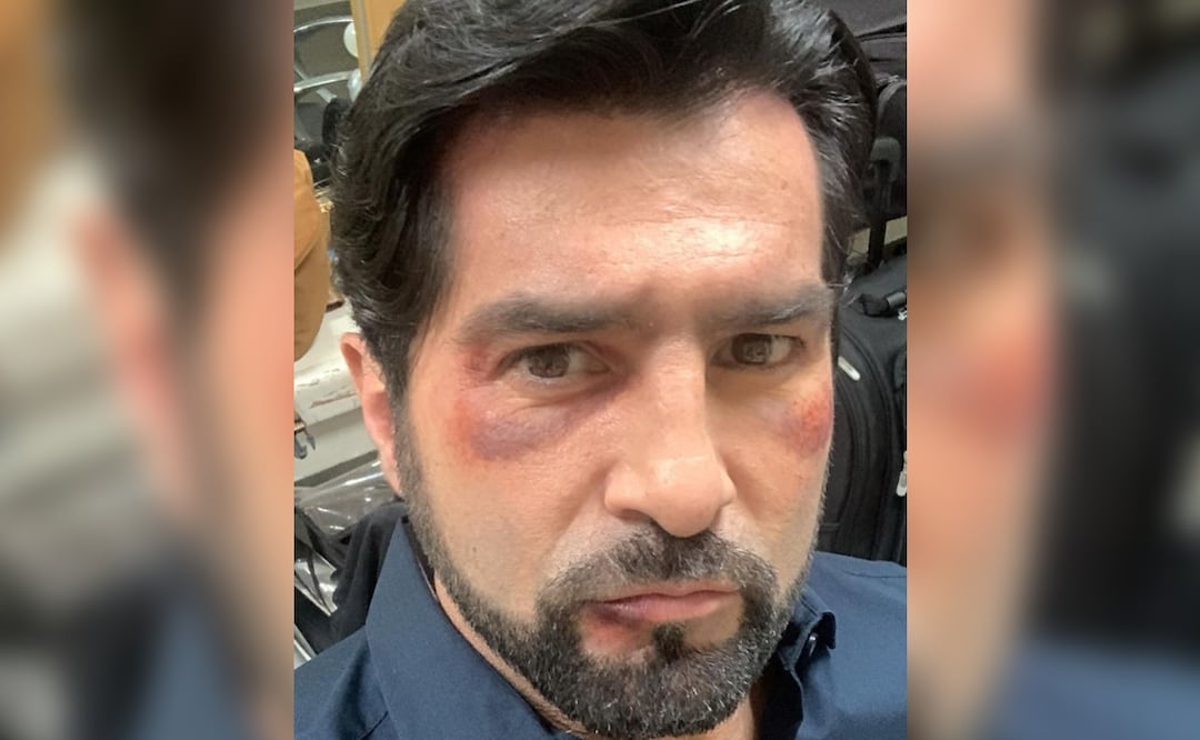 Arturo Carmona le entra al héroe con gañán que se quiso pasar de listo y damita le entra a quite