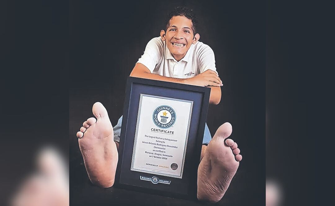  ¿Cuál es el tamaño del pie más grande del mundo? Un venezolano ostenta el récord