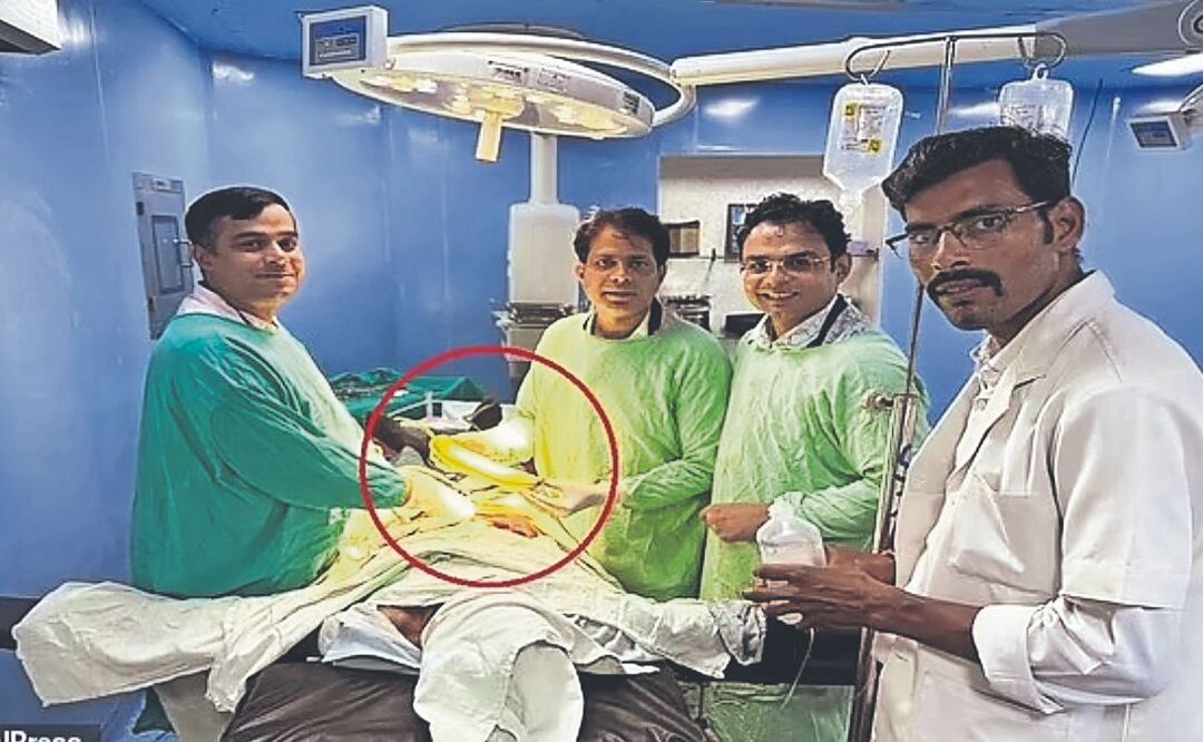 Le sacan calabaza del recto a un agricultor en la India