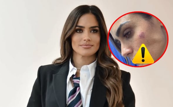 Alessandra Rojo de la Vega es atacada a golpes por vendedores ambulantes en la Avenida San Cosme