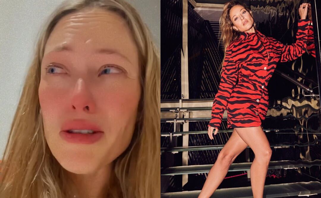 Pican a Vanessa Huppenkhoten y pide ayuda para obtener una solución 