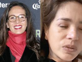 ¡Entre lágrimas! Yolanda Andrade revela la verdad detrás de su estado de salud y causa conmoción