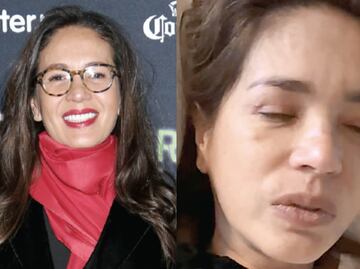 ¡Entre lágrimas! Yolanda Andrade revela la verdad detrás de su estado de salud y causa conmoción