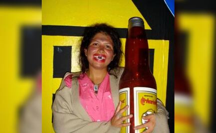 La Chupitos cuenta cómo se encuentra de enfermedad por la que recibió quimioterapia