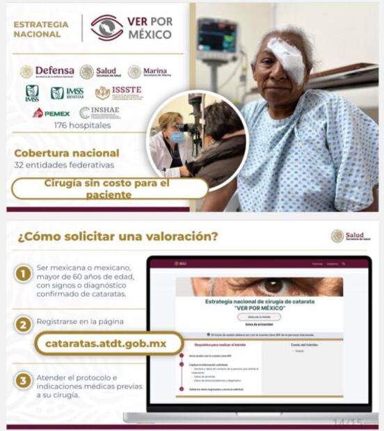 operacion-gratis-cataratas.jpg