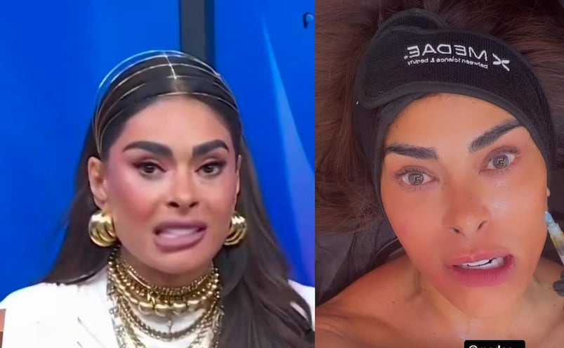 ¿Galilea Montijo es adicta a las cirugías? Sorprende con nuevo arreglito en el rostro 