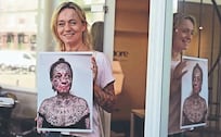Su ex le tatuó su nombre 250 veces: Así logró borrar las marcas de años de violencia
