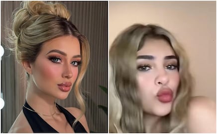 Vivian de la Torre, amiga de Valeria Márquez hace tremenda confesión de sus cirugías ¿quién las paga?