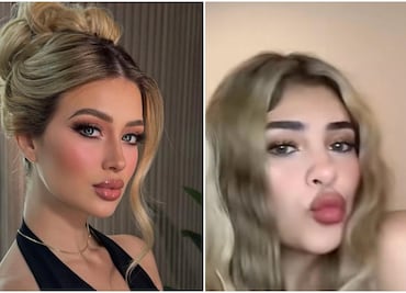 Vivian de la Torre, amiga de Valeria Márquez hace tremenda confesión de sus cirugías ¿quién las paga?