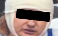 Atoran a mujer que se echó a su hermano para ganarle los terrenos de la familia, en Tlalpan