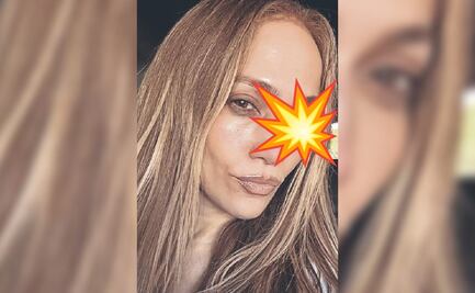 ¿Qué le pasó a Jennifer Lopez en la cara? Revela accidente antes de los American Music Awards