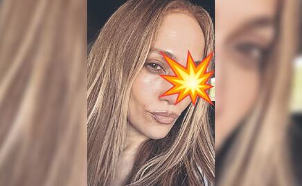¿Qué le pasó a Jennifer Lopez en la cara? Revela accidente antes de los American Music Awards