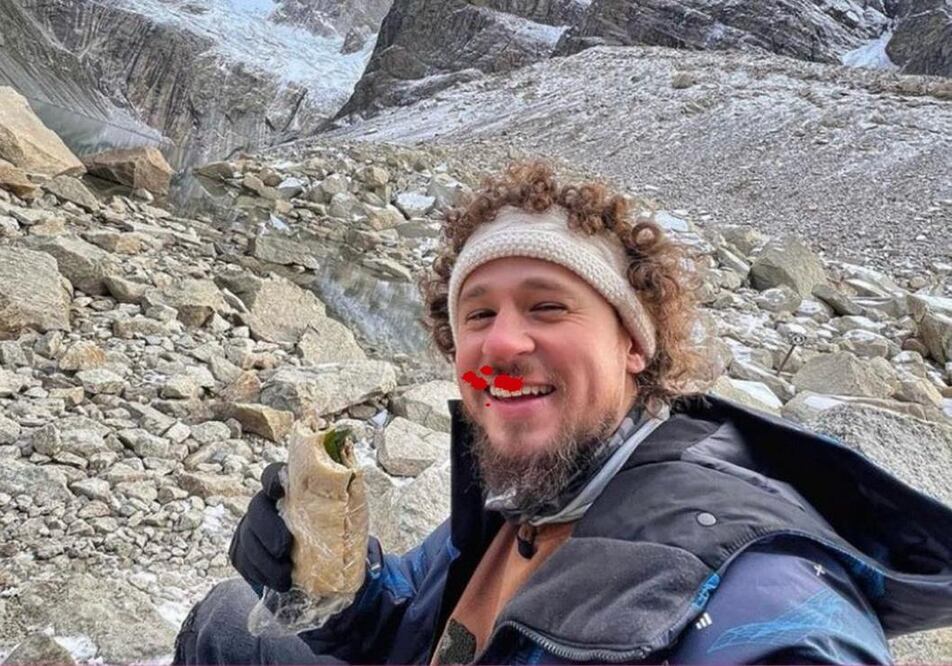 Se le cae un diente a Luisito Comunica en plena transmisión y todos se burlan con memes