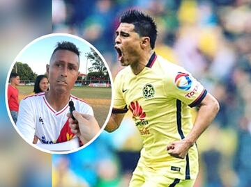 Osvaldo Martínez ex jugador del América padece esclerodermia ¿En qué consiste la enfermedad?