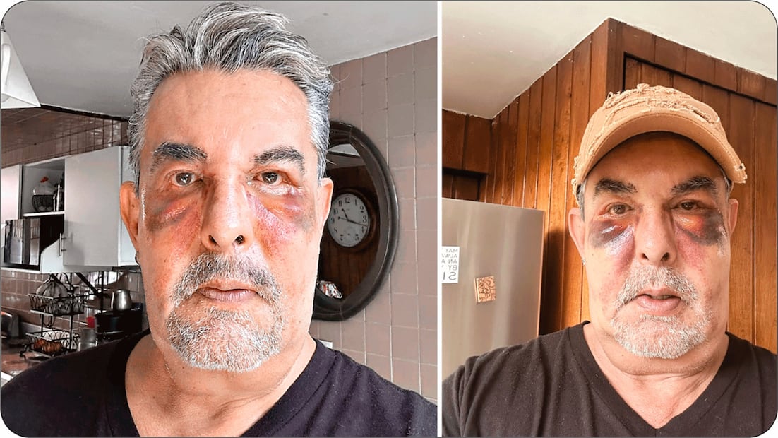 Antonio Escobar (Vía: Redes)