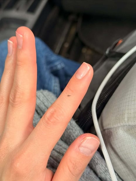 ¡Invasión de trips en CDMX! Crece preocupación por los insectos que provocan ardor en los ojos. Foto: (Especial)