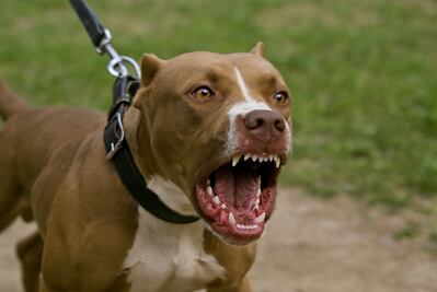 Pitbull ataca sin control a mujer de 73 años y la deja al borde de la muerte, en Iztapalapa