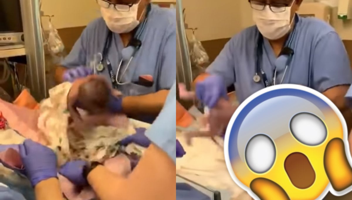 VIDEO Beb Recin Nacida Se Le Resbala A Mdico Y Cae De Cabeza El