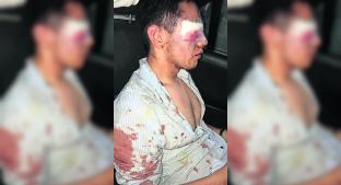  Tras riña en bar, sujeto acusa a excandidato del PRD por tranquiza en Morelos. Noticias en tiempo real