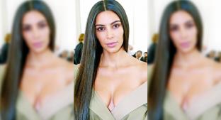 Kim Kardashian rompe el silencio y revela lo difícil que ha sido padecer psoriasis . Noticias en tiempo real