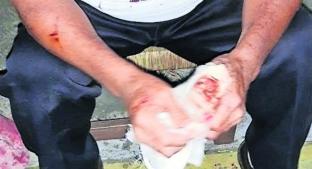 Taxista intentó defenderse de asalto pero le dieron navajazos en la cara, en Jiutepec. Noticias en tiempo real
