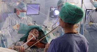 Mujer con tumor cerebral toca el violín, mientras le practican peligrosa cirugía . Noticias en tiempo real
